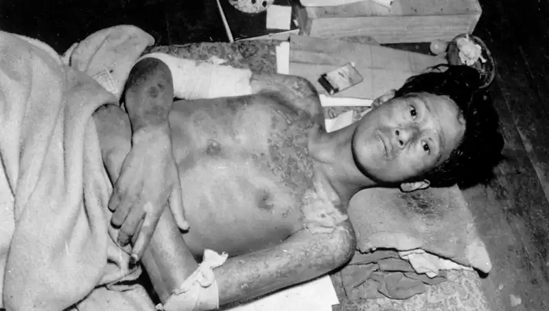 80 Yıl Sonra Nagasaki’den Nükleer Tehdit Uyarısı: İnsanlık Ne Yapmalı?