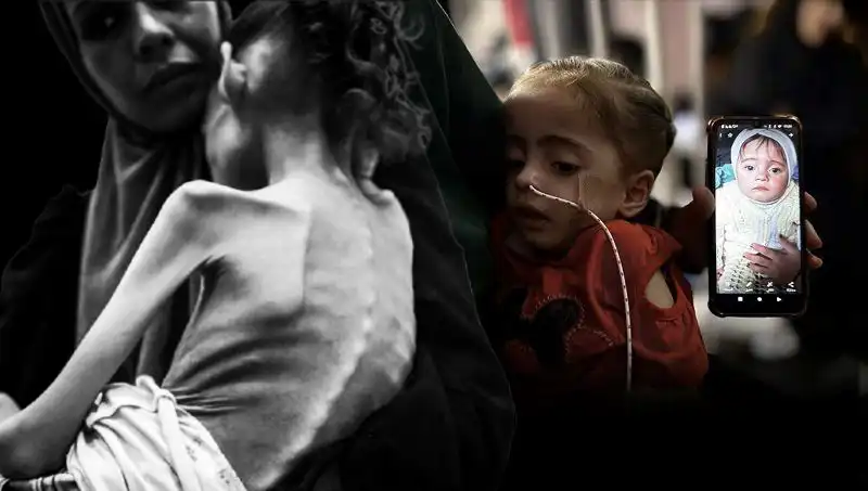 Küçük Meryem'in Hayatta Kalma Mücadelesi: 25 Kilodan 10 Kiloya Düşüş
