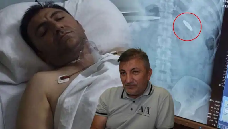 15 Temmuz’un Unutulmaz Acısı: Vücudunda Kurşunla Yaşayanlar